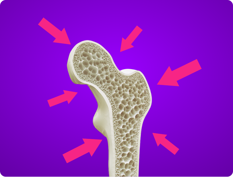 Forget fractures: The genetic test that will help you prevent bone density loss